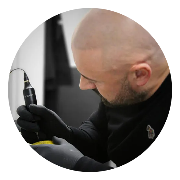 Natural-looking Scalp Micropigmentation result