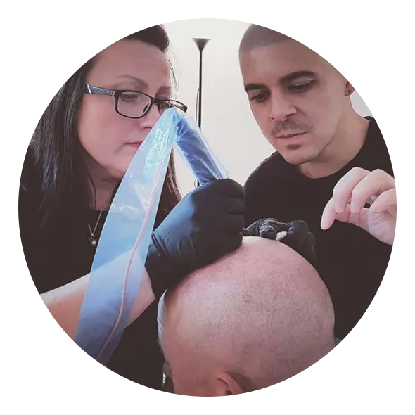 Scalp Micropigmentation treatment being performed